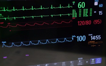 monitor showing heart rate